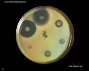 antiiotic disks diffusion test